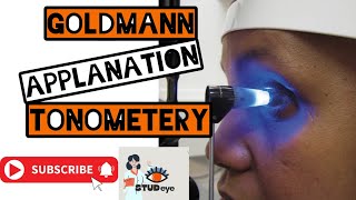 Goldmann Applanation Tonometer  Tonometry [upl. by Veta]