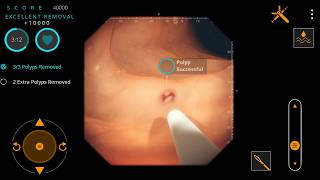 Gastro Ex Video Game for Gastroenterologists [upl. by Behl113]