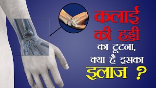 Colles Fracture I कलाई की हड्डी का टूटना लक्षण और उपचार I Dr Ankit Bhartia [upl. by Tzong109]