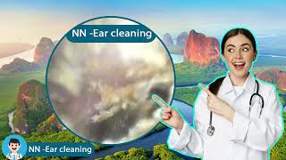 Ear endoscopy cleaning for several childrens ears [upl. by Paulie]