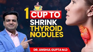 1 Cup Remedy to Shrink Thyroid Nodules [upl. by Alla116]