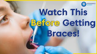 What To Know Before Getting Braces  8 Tips To Prepare You For Braces [upl. by Nahseez]