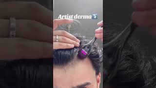 Derma Roller for Hair and Beard Growth dermaroller viralshorts howto newproducts fexicart [upl. by Marla]