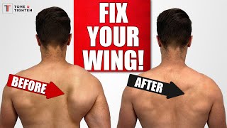 FIX Scapular Winging with Shoulder Blade Exercises [upl. by Nessim]