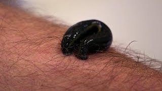 Michael Mosley is bitten by a leech  Infested Living with Parasites  BBC Four [upl. by Halilak881]