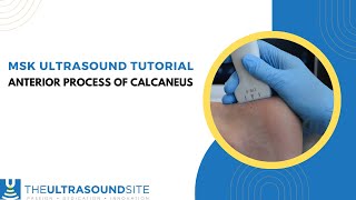 MSK ultrasound evaluation on how to find the anterior process of the calcaneus [upl. by Knowlton]