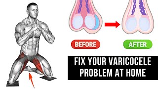 Top 6 Effective Exercises for Varicocele Treatment at Home [upl. by Yatnwahs]