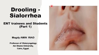 Drooling Sialorrhea ENT trainees and Students Part 1 [upl. by Philemon]