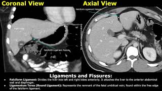 Liver CT Anatomy  Surfaces Lobes Ligaments amp Fissures Porta Hepatis Portal Vein Hepatic Artery [upl. by Lavinie]