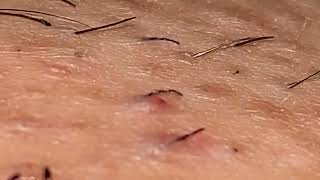 pluck hair satisfying hair removal [upl. by Zelig]