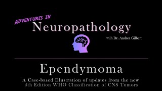 Ependymoma Update from the 5th Edition WHO Classification of CNS Tumors [upl. by Susanetta294]