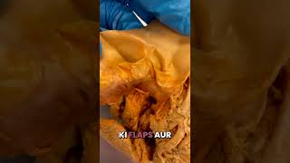 AMAZING Human Heart Valves in Hindi [upl. by Tenaej]