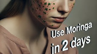 🌿 MORINGA NATURAL RELIEF FOR SKIN RASHES 🌱 [upl. by Westbrooke]