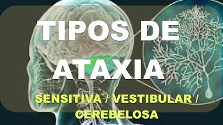 Ataxia Diagnóstico Diferencial Vestibular Sensitivo Cerebeloso [upl. by Aldin305]