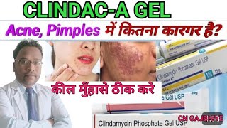 How to use ClindacA gel how to apply ClindacA gelusesside effectsbenefits cngajbhiye [upl. by Avner]