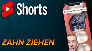 Zahn ziehen shorts [upl. by Pinebrook]