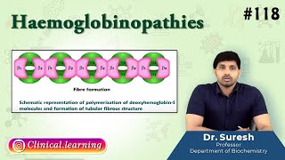 118 Haemoglobinopathies  Medical Biochemistry  USMLE FMGE and NEET PG [upl. by Aztinaj58]