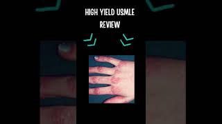 Dermatomyositis Review shorts [upl. by Ahseniuq]