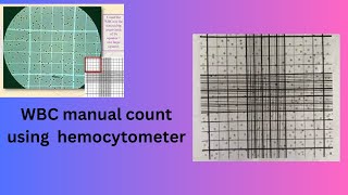 WBC manual count using hemocytometer [upl. by Enenstein]