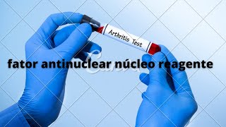 fator antinuclear núcleo reagente [upl. by Kwon]