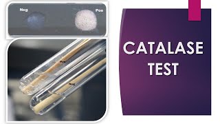 Catalase Test [upl. by Iruyas]