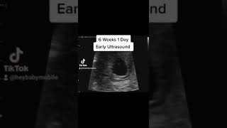 Heartbeat on Early Ultrasound at 6 Weeks 1 Day Pregnant [upl. by Rats]