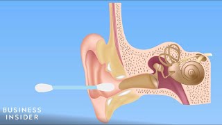 Forget QTips — Here’s How You Should Be Cleaning Your Ears [upl. by Cleaves126]