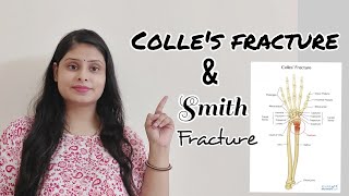 Colles fracture in hindi  smiths fracture in hindi  easy explanation  Anatomy easy videos [upl. by Ennovihs]