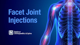 What are Facet Joint injections [upl. by Araeit]