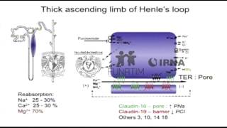 Hipomagnesemia con hipercalciuria y nefrocalcinosis [upl. by Rondon]