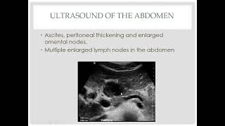 Radiologic features of mesenteric and omental pathologies [upl. by Assylla292]