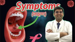 Mouth Cancer Symptoms  You did not know I मुँह के कैंसर के लक्षण II Dr Yash Chaddha [upl. by Aynodal]