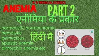 Anemia amp its types simple एक्सप्लनेशन हिंदी ANEMIA PART 2 [upl. by Letnuhs]