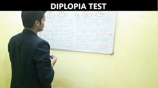 Diplopia Test [upl. by Kaufmann]