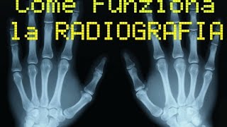 Come funziona la RADIOGRAFIA [upl. by Ocirederf]