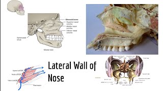 Lateral wall of nasal cavity [upl. by Eigroeg]