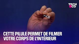 Cette pilule permet de filmer votre corps de l’intérieur [upl. by Allistir825]