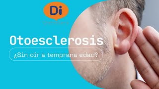 Otoesclerosis ¿Sin oír a temprana edad [upl. by Vasya]