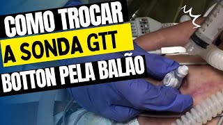 Troca da GTT Boton pela GTT balão passo a passo sondagem gastronomia gastrostomia enfermagem [upl. by Sikata687]