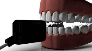 Dental Sensor  Owandy Visteo new concept in Digital Radiography [upl. by Soll941]