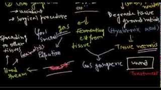 Clostridium perfringens infection and pathogenesis [upl. by Erbma]