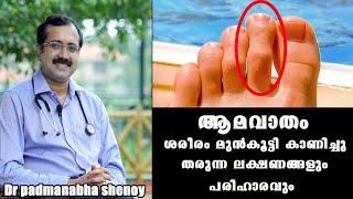 ഈ ലക്ഷണം നിങ്ങൾക്കുണ്ടോ ശ്രദ്ധിക്കുക Dr Padmanabha shenoy RheumatismBaijus Vlogs [upl. by Bubb]