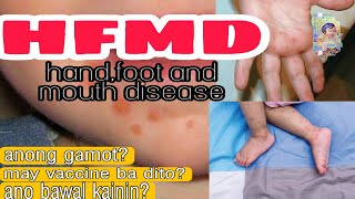 Rashes sa Kamay Paa at bibigHand foot and mouth disease HFMDTagalog ExplainedDr PediaMom [upl. by Julita]