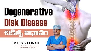 How is degenerative disk disease treated  Degenerative Disk Disease  Health video Dr GPV Subbaiah [upl. by Nwahsan789]