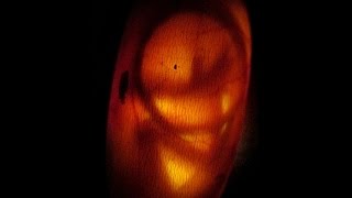 Bearded Dragon Embryo  45 days old [upl. by Retrak288]