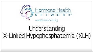 X Linked Hypophosphatemia XLH [upl. by Isaacson]