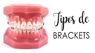 CONOCE LOS TIPOS DE BRACKETS  ¿CUÁLES SON MEJORES [upl. by Brenden206]