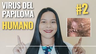 Virus del Papiloma Humano Parte 2 [upl. by Gitel70]