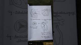 Assignment on valvular heart disease MSNIIgnm2ndyear bscnursing assignment notes study [upl. by Wallinga]