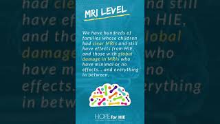 HIE Levels Explained  Hypoxic Ischemic Encephalopathy [upl. by Eilssel]